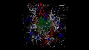 PIA-STUDY: Probucol in Alzheimer’s Study